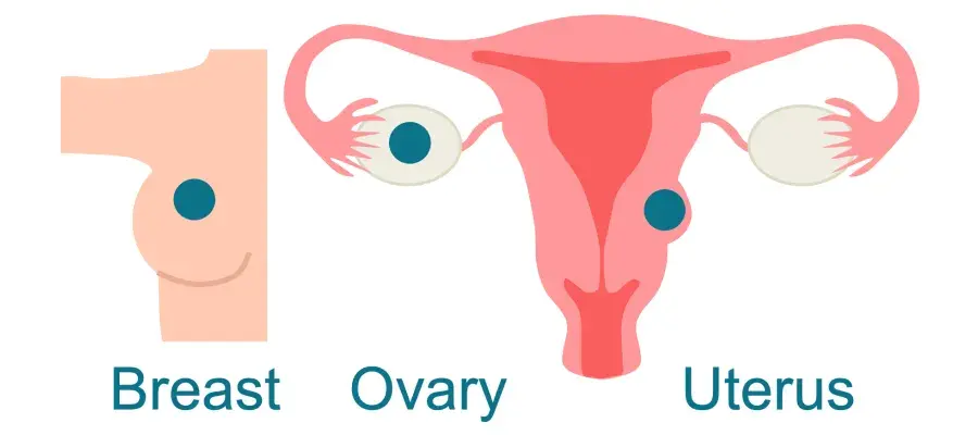 Infographic of breast, ovary and uterus