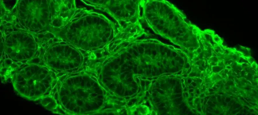 microscopy image of tissue