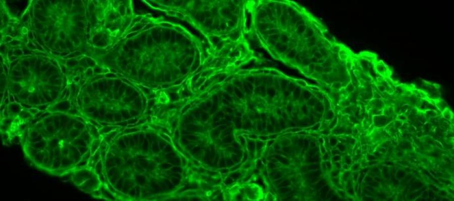 microscopy image of tissue