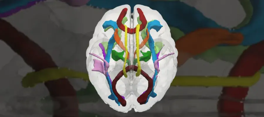 Neonatal brain tacts