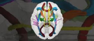 Neonatal brain tacts