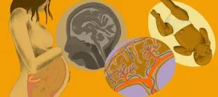 artisitic interpretation of a newborn babie, uterus lining, fetal brain scan and baby in the womb