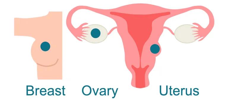 Infographic of breast, ovary and uterus