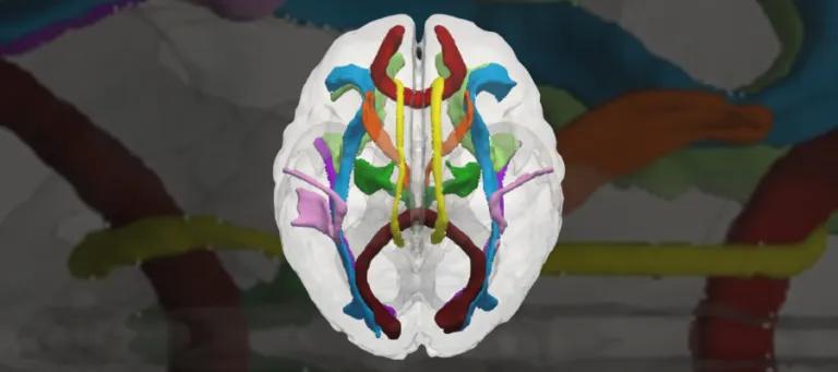 Neonatal brain tacts