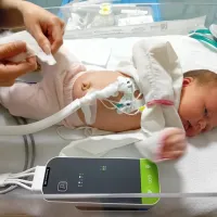 Baby having its ECG